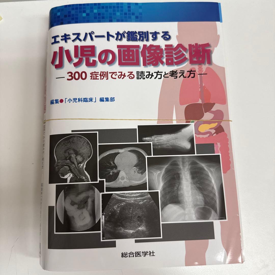 裁断済　エキスパートが鑑別する小児の画像診断 : 300症例でみる読み方と考え方